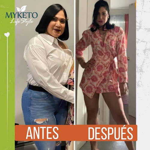 Antes y Despues Dieta Keto