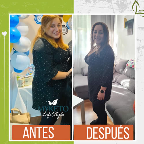 Antes y Despues Dieta Keto