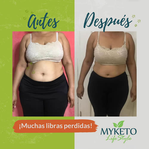 Antes y Despues Dieta Keto