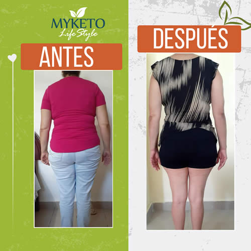 Antes y Despues Dieta Keto