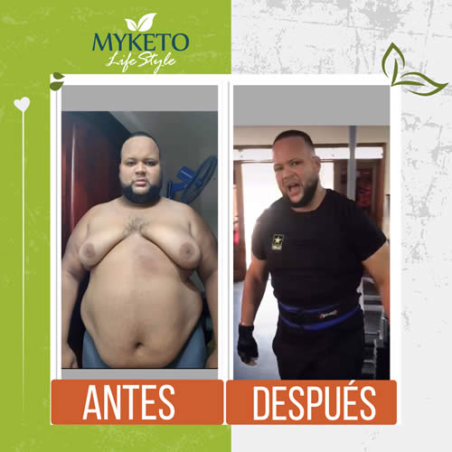 Antes y Despues Dieta Keto