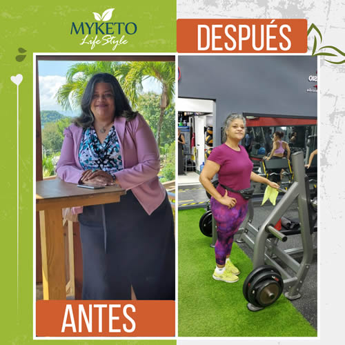 Antes y Despues Dieta Keto