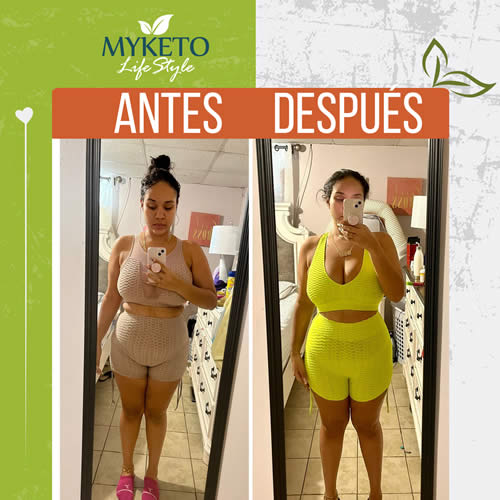Antes y Despues Dieta Keto