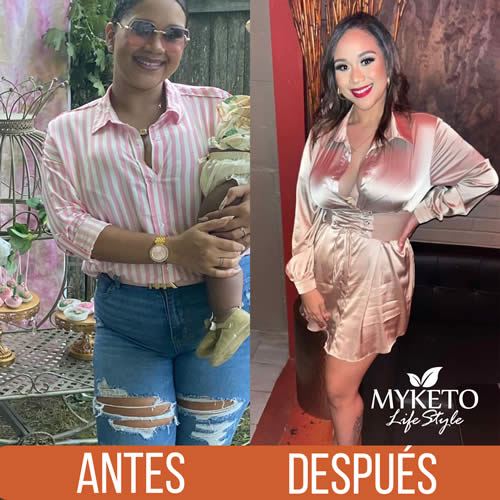 Antes y Despues Dieta Keto